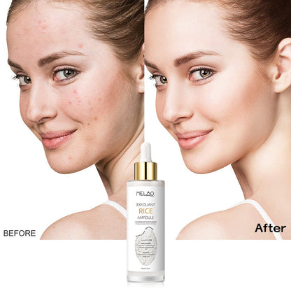 Peel Shot Coréen - Purifie la peau et révèle son éclat